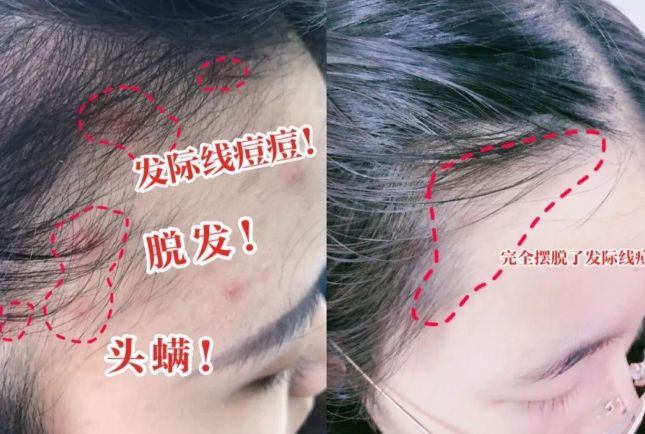 好？10分钟轻松养成女明星「绸缎发」冰球突破平台洗完头自然风干还是吹干(图15)